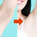 No más navajas, el vello facial y corporal se deshace de él con este querido ingrediente.