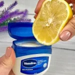 Mix Vaseline with Lemon! If only I had known this earlier
