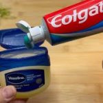 Mix toothpaste and vaseline, I didn’t expect it to be this effective